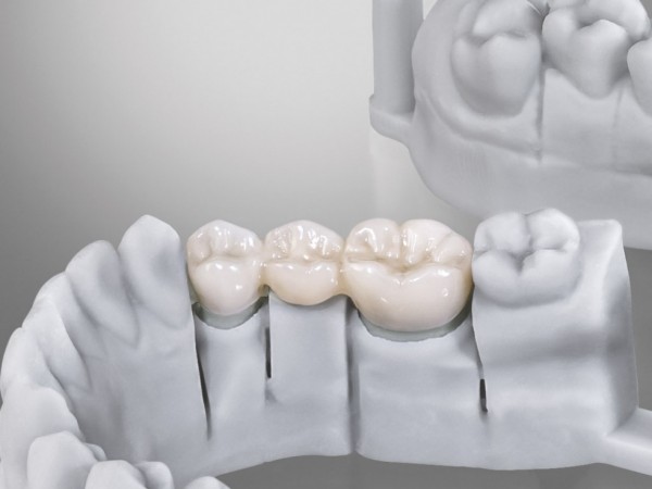 3D printer for dental