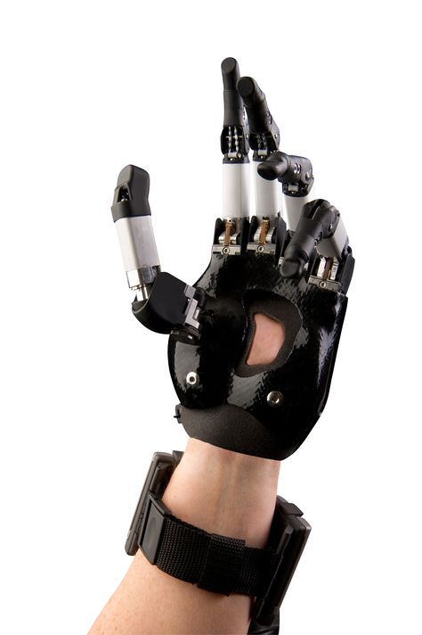 3D printed artificial limbs