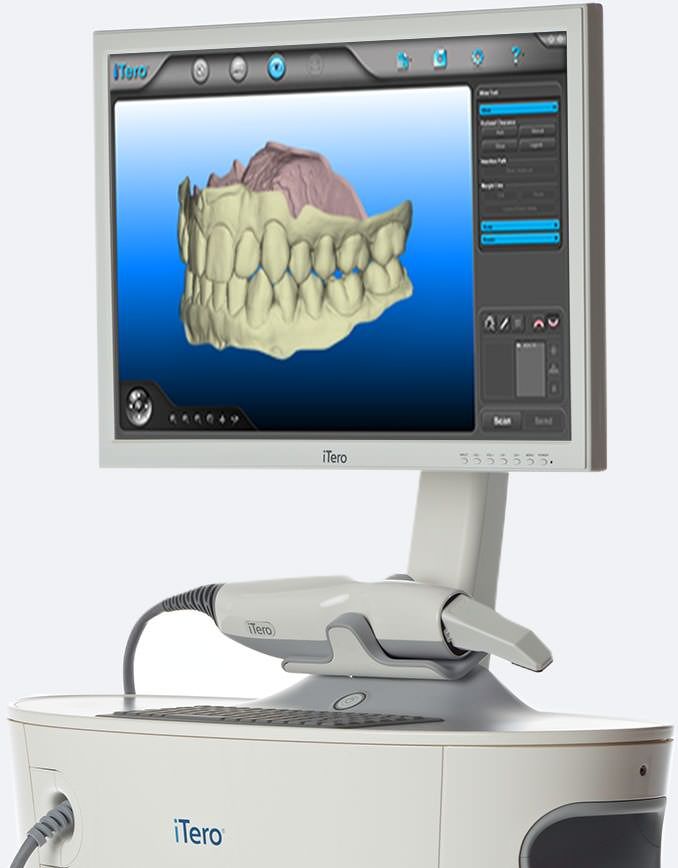 Dentist 3d scanner