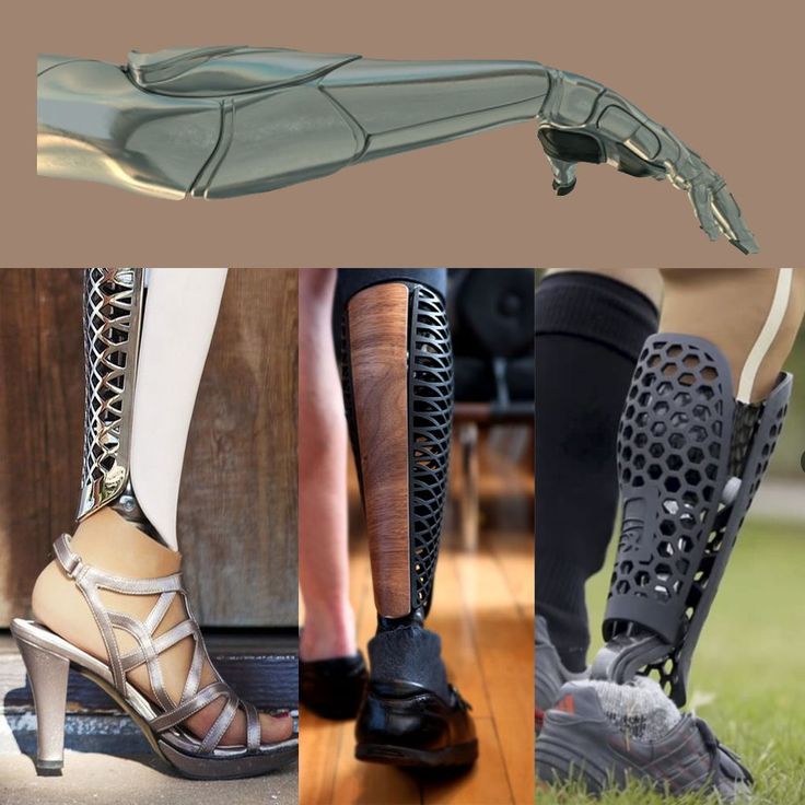 3D printed limb