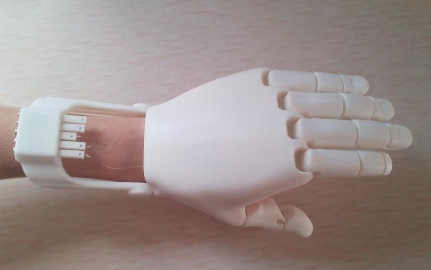 3D printed prosthetics hand