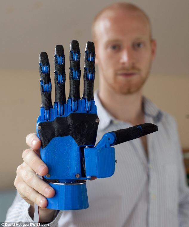 3D printed prosthetic arm cost