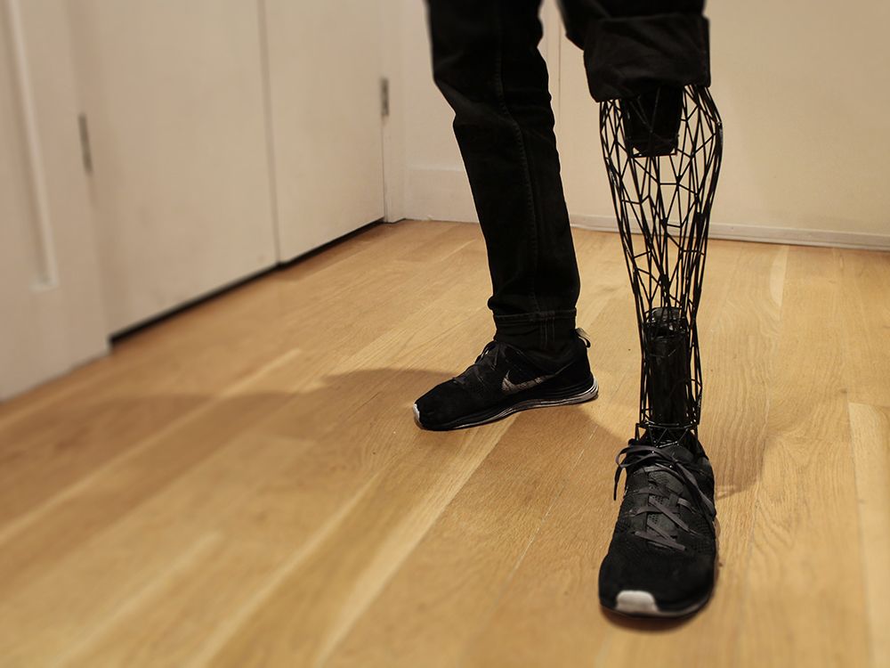 3D printing prosthetics cost