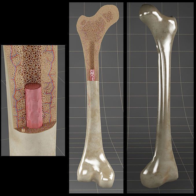 3D printed titanium femur