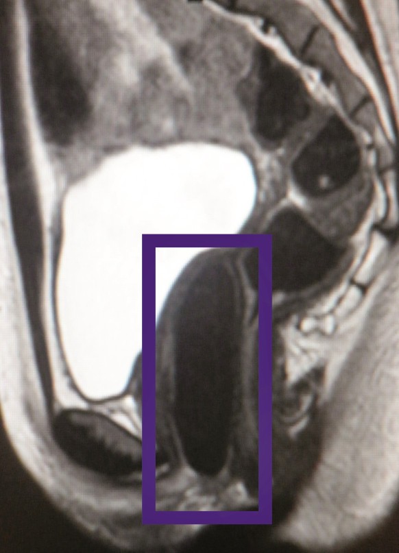 Wake forest institute for regenerative medicine 3d printing Wake forest institute for regenerative medicine 3d printing