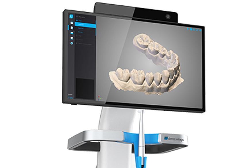 Intraoral 3d scanner