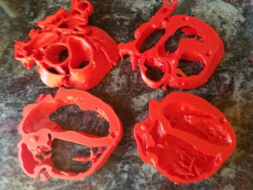 3D print anatomical heart