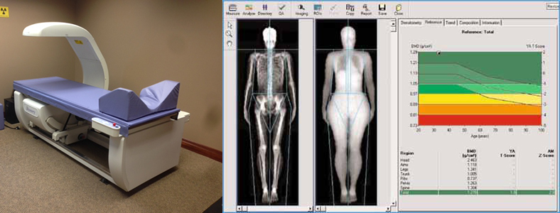 Size stream ss20 3d body scanner